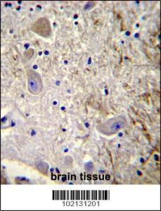 Anti-MAGEL2 Rabbit Polyclonal Antibody (APC (Allophycocyanin))