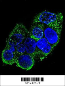 Anti-COL8A2 Rabbit Polyclonal Antibody (HRP (Horseradish Peroxidase))