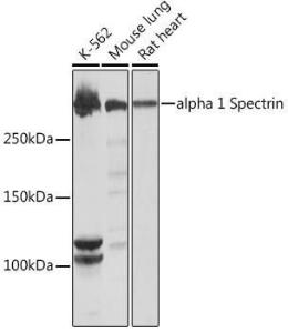 Western blot analysis of extracts of various cell lines, using Anti-alpha 1 Spectrin Antibody [ARC1650] (A306701) at 1:1000 dilution