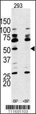 Anti-RPS6KB1 Rabbit Polyclonal Antibody (AP (Alkaline Phosphatase))