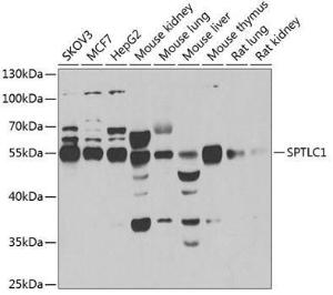 Western blot analysis of extracts of various cell lines, using Anti-SPTLC1 Antibody (A12011) at 1:1,000 dilution