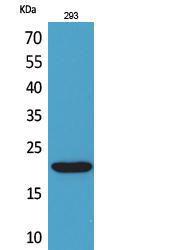 Anti-CMTM6 antibody