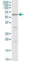 Anti-MKKS Rabbit Polyclonal Antibody