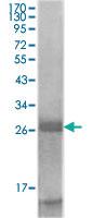 Anti-KLK3 Mouse Monoclonal Antibody [clone: 5A11E9,5A11E2]