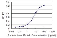 Anti-HIPK1 Mouse Monoclonal Antibody [clone: 4D5]