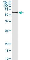 Anti-TRIM62 Polyclonal Antibody Pair