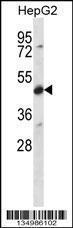 Anti-CDR2 Rabbit Polyclonal Antibody (FITC (Fluorescein Isothiocyanate))