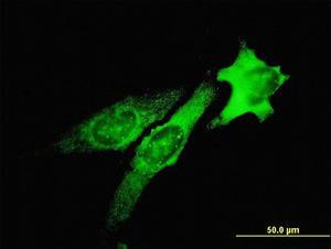 Anti-TSG101 Mouse Monoclonal Antibody [clone: 5B7]