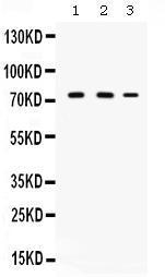 Anti-CYP11A1 Antibody