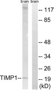 Western blot analysis of lysates from rat brain cells using Anti-TIMP1 Antibody. The right hand lane represents a negative control, where the Antibody is blocked by the immunising peptide