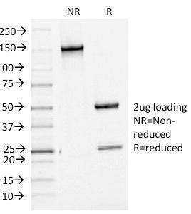 Antibody anti-BCL-6 BCL61475 100 µg