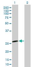 Anti-IL6 Mouse Polyclonal Antibody