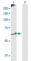 Anti-MKKS Rabbit Polyclonal Antibody