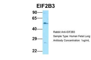 Anti-EIF2B3 Rabbit Polyclonal Antibody