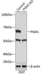 Western blot analysis of extracts from normal (control) and PGM1 knockout (KO) 293T cells, using Anti-PGM1 Antibody (A307970) at 1:1,000 dilution. The secondary antibody was Goat Anti-Rabbit IgG H&L Antibody (HRP) at 1:10,000 dilution.