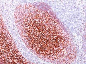 Immunohistochemical analysis of formalin-fixed, paraffin-embedded human tonsil using Anti-CD35 Antibody [CR1/802]