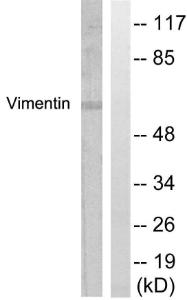 Western blot analysis of lysates from A549 cells, treated with Nocodazole 1 µg/ml 16h using Anti-Vimentin Antibody. The right hand lane represents a negative control, where the antibody is blocked by the immunising peptide