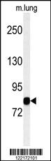 Anti-MAP3K11 Rabbit Polyclonal Antibody