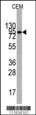 Anti-PI3KR1 Rabbit Polyclonal Antibody