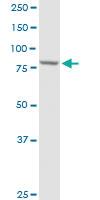 Anti-PFKP Rabbit Polyclonal Antibody