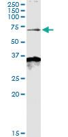 Anti-MKKS Rabbit Polyclonal Antibody