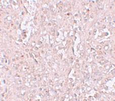 Anti-SLC39A13 Rabbit Polyclonal Antibody