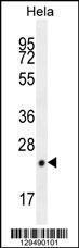 Anti-CPSF4L Rabbit Polyclonal Antibody (FITC (Fluorescein Isothiocyanate))