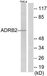 Western blot analysis of lysates from HeLa cells using Anti-ADRB2 Antibody. The right hand lane represents a negative control, where the antibody is blocked by the immunising peptide