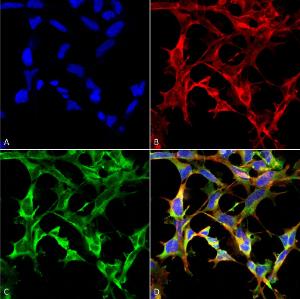 Immunocytochemistry/Immunofluorescence analysis of human embryonic kidney epithelial cell line (HEK293), fixed in 5% formaldehyde for 5 minutes, using Anti-Nitrotryptophan Antibody [4F8] (A304724), at 1:50 for 30-60 min at room temperature