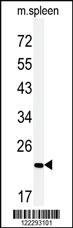 Anti-COPZ2 Rabbit Polyclonal Antibody