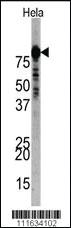 Anti-PI3KR1 Rabbit Polyclonal Antibody