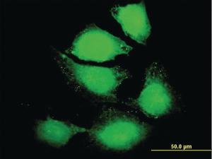 Anti-IL6 Mouse Polyclonal Antibody