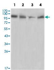 Anti-PTK2B Mouse Monoclonal Antibody [clone: 5E2D5]