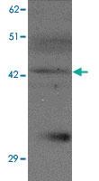 Anti-SLC39A13 Rabbit Polyclonal Antibody