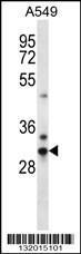 Anti-CDRT15P2 Rabbit Polyclonal Antibody (AP (Alkaline Phosphatase))