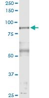 Anti-PFKP Rabbit Polyclonal Antibody