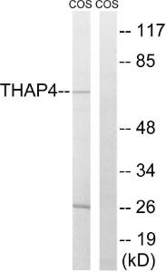 Western blot analysis of lysates from COS7 cells using Anti-THAP4 Antibody. The right hand lane represents a negative control, where the antibody is blocked by the immunising peptide