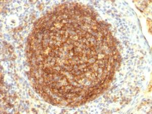 Immunohistochemical analysis of formalin-fixed, paraffin-embedded human tonsil using Anti-CD35 Antibody [CR1/802]