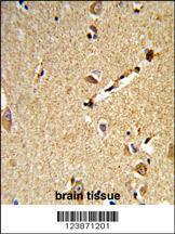 Anti-DLL3 Rabbit Polyclonal Antibody (FITC (Fluorescein Isothiocyanate))