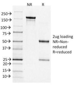 SDS-PAGE analysis of Anti-Bcl-6 Antibody [BCL6/1526] under non-reduced and reduced conditions; showing intact IgG and intact heavy and light chains, respectively. SDS-PAGE analysis confirms the integrity and purity of the antibody