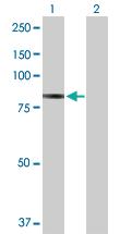 Anti-PFKP Rabbit Polyclonal Antibody