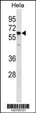 Anti-CCT7 Rabbit Polyclonal Antibody (AP (Alkaline Phosphatase))