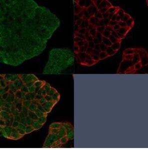 Anti-Bcl2L2 antibody