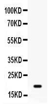 Anti-GADD45A Antibody