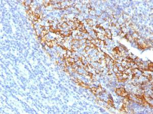 Immunohistochemical analysis of formalin-fixed, paraffin-embedded human tonsil using Anti-CD35 Antibody [To5]