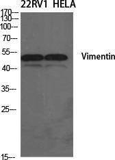 Western blot analysis of various cells using Anti-Vimentin Antibody