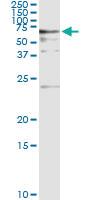 Anti-BAIAP2 Antibody Pair