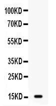 Anti-GIP Antibody