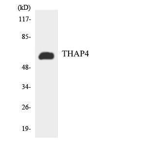 Western blot analysis of the lysates from HT 29 cells using Anti-THAP4 Antibody