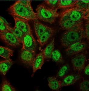 Immunofluorescent analysis of PFA fixed HeLa cells stained with Anti-p40 Antibody [ZR8] followed by Goat Anti-Rabbit IgG (CF&#174; 488) (Green). Counterstain is Phalloidin (Red)